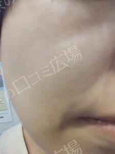 治療前の症例写真