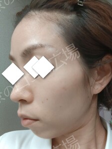 治療前の症例写真