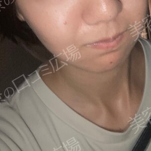 治療結果の症例写真