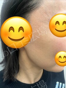 治療前の症例写真