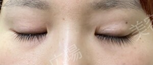 治療結果の症例写真