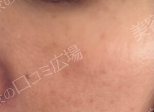 治療結果の症例写真