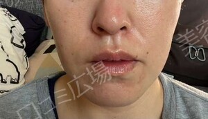 治療結果の症例写真