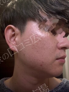 治療結果の症例写真