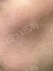 治療結果の症例写真