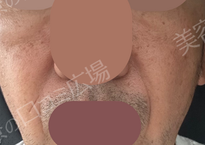 治療前の症例写真