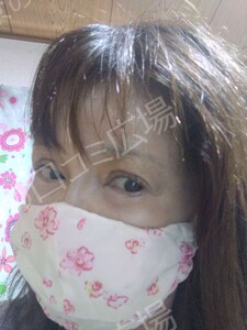 治療直後の症例写真