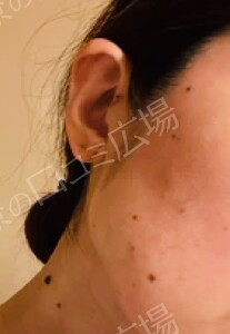 治療前の症例写真