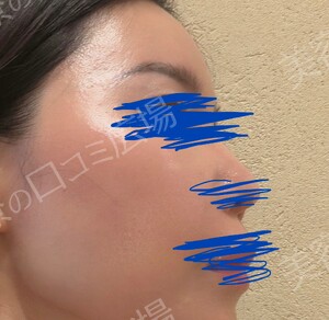 治療結果の症例写真
