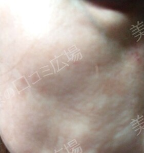治療前の症例写真
