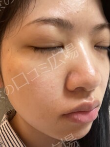 治療前の症例写真