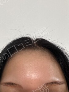治療結果の症例写真
