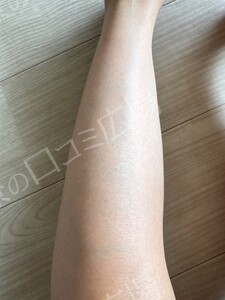 治療前の症例写真