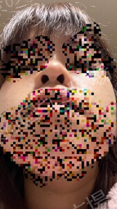 治療結果の症例写真