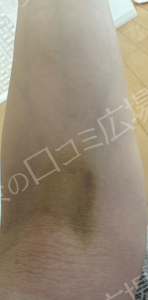 治療結果の症例写真