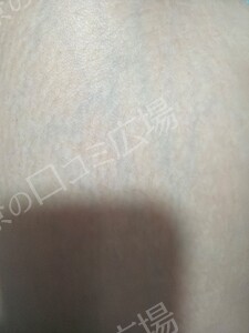 治療結果の症例写真