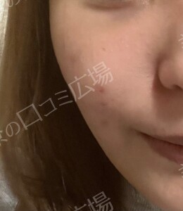 治療結果の症例写真