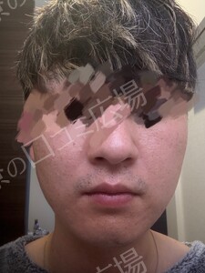 治療結果の症例写真
