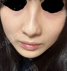 治療前の症例写真