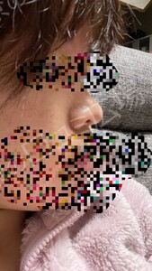 治療結果の症例写真
