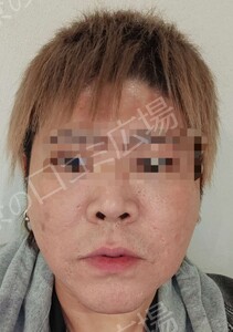 治療前の症例写真