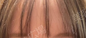 治療前の症例写真