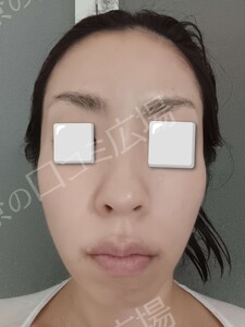 治療結果の症例写真