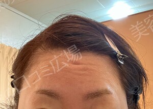 治療前の症例写真