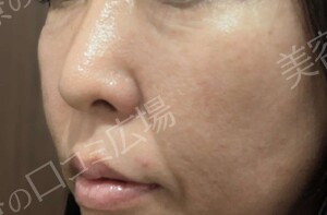 治療前の症例写真