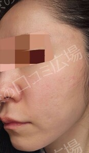 治療結果の症例写真