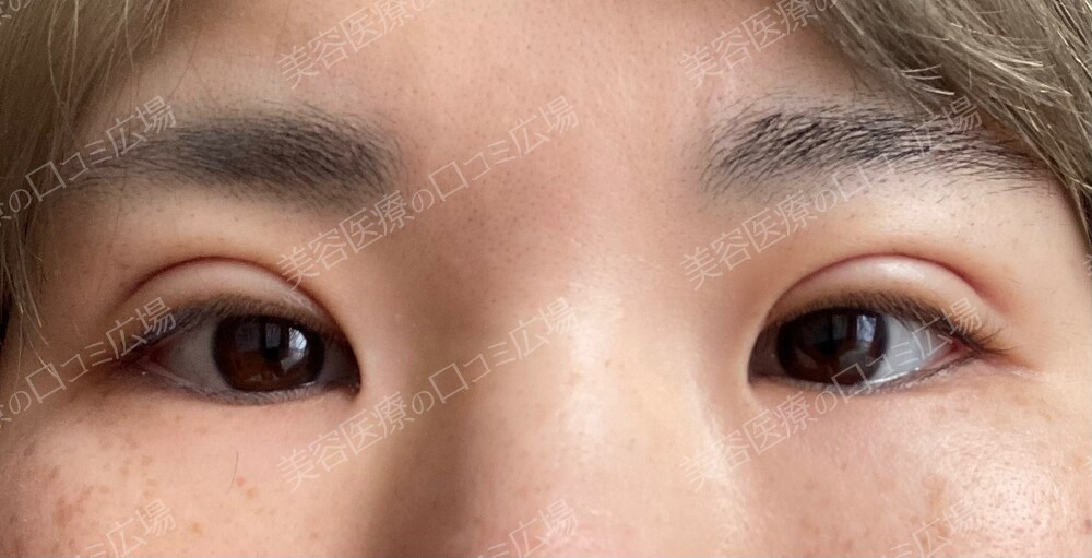 プロノスティコ