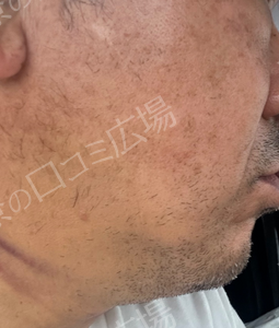 治療前の症例写真