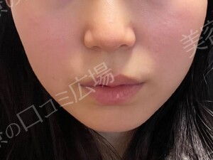 治療前の症例写真