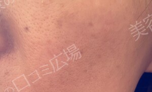 治療前の症例写真