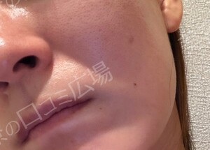 治療結果の症例写真