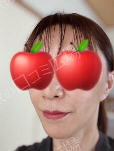 治療結果の症例写真