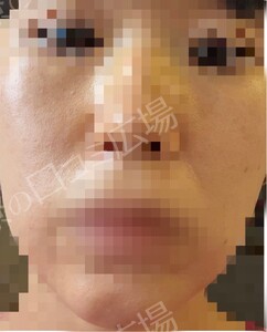 治療結果の症例写真