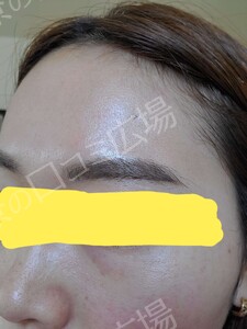 治療前の症例写真