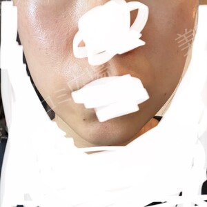 治療前の症例写真