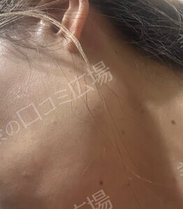 治療結果の症例写真