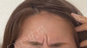 治療前の症例写真