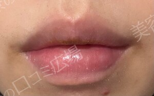 治療結果の症例写真