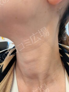 治療結果の症例写真