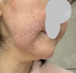 治療前の症例写真
