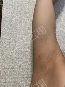 治療結果の症例写真