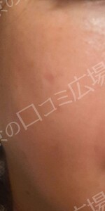 治療結果の症例写真