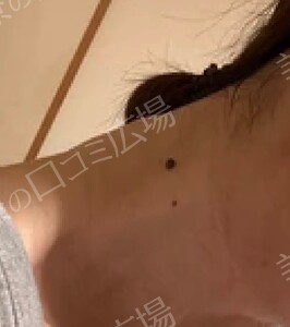 治療前の症例写真