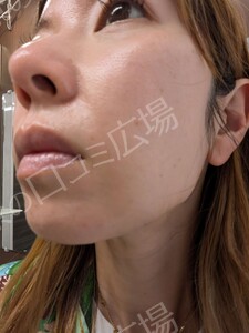 治療前の症例写真