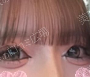 治療結果の症例写真