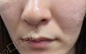 治療前の症例写真